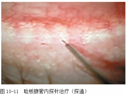ZY016_48_4.gif